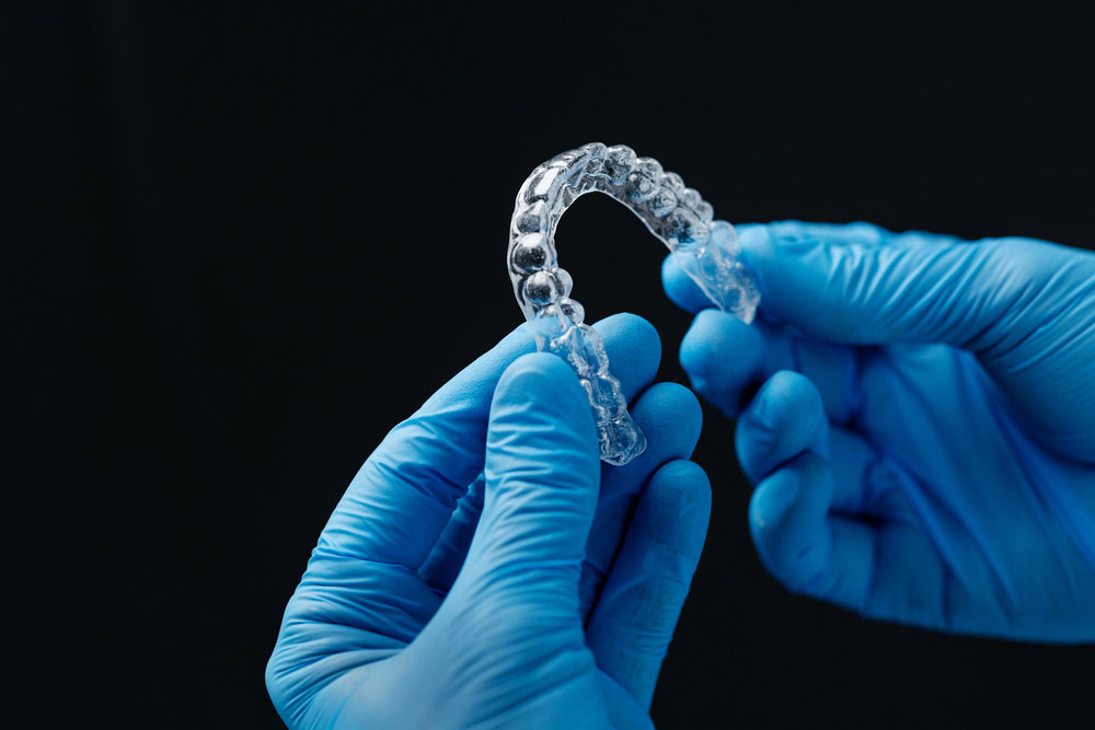 Clear Aligners